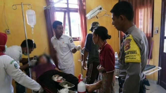 Duel dengan Beruang, Kepala Muntamah Kini Penuh Luka Jahitan