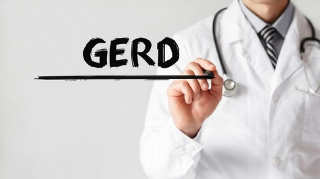 Ilustrasi penyakit GERD dan asam lambung. (Shutterstock)