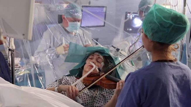 Seorang pasien memainkan biola saat menjalani operasi pengangkatan tumor di otaknya di King's College Hospital, London, 31 Januari 2020. [AFP]