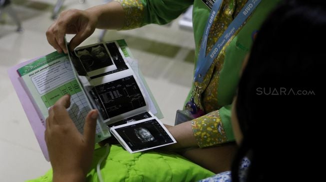 Tim Dokter menunjukkan hasil USG kandungan dari Regina (43) yang akan menjalani proses persalinan di RSUD Pasar Minggu, Jakarta, Kamis (20/2). [Suara.com/Angga Budhiyanto]