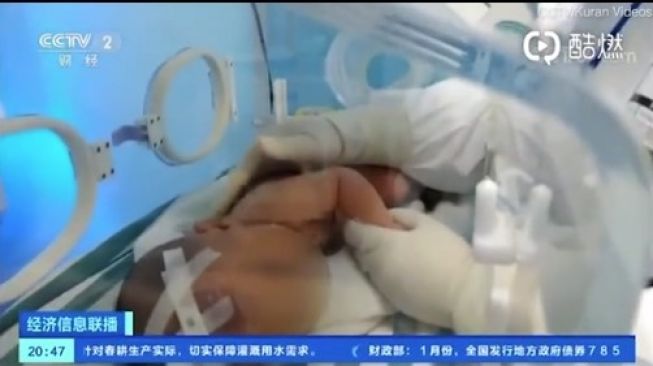 Xiao Xiao, pasien termuda yang sembuh dari infeksi virus corona (YouTube/CCTV2)