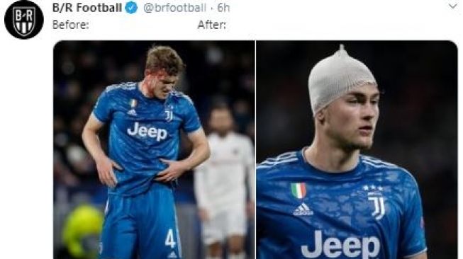 De Ligt mengalami luka di kepala dalam pertandingan Juventus vs Lyon. (Twitter/@brfootball).