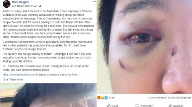 Constantine, mahasiswa asal China dipukul karena tidak bahasa Inggris (Facebook Mark Holgate)
