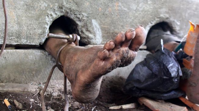 Orang Dengan Gangguan Jiwa (ODGJ) berinisial SY berada dalam pasungan beton selama empat tahun sebelum di evakuasi di Dampit, Malang, Jawa Timur, Selasa (3/3).   [ANTARA FOTO/Ari Bowo Sucipto]