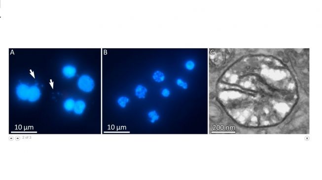 Parasit di ikan salmon. [Pnas.org]