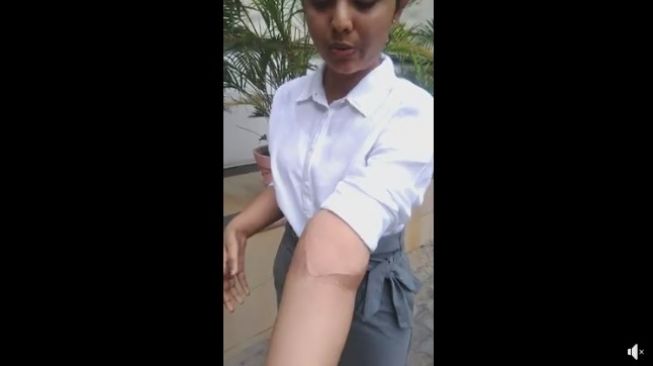 Shreya mendapat transplantasi tangan dari seorang lelaki (Facebook/MOHAN Foundation)