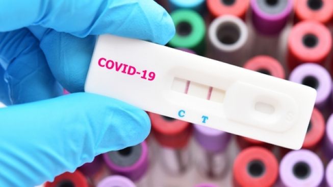 Ilustrasi rapid test virus Corona Covid-19. (Shutterstock)