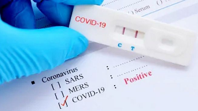 Rapid Test Sukoharjo: 1 Pemudik di Nguter Positif Corona