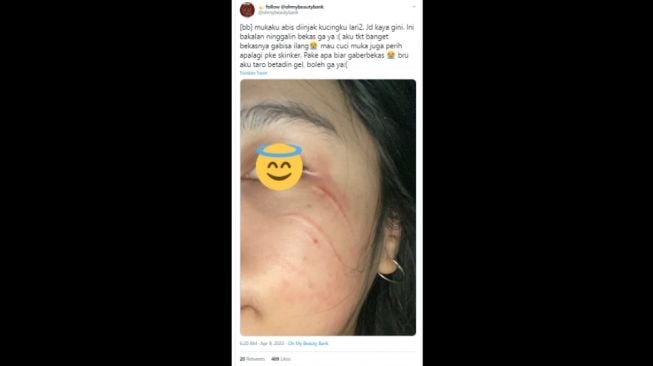 Sedih, Wanita Ini Curhat Wajahnya Luka Dicakar Kucing Kesayangan