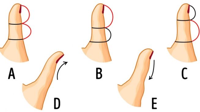 Tes kepribadian bentuk jempol ungkap kepribadian. (Dok. Brightside)