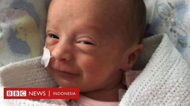 Bayi Prematur Usia Tiga Minggu Terjangkit Corona, Ini Kisah Kesembuhannya