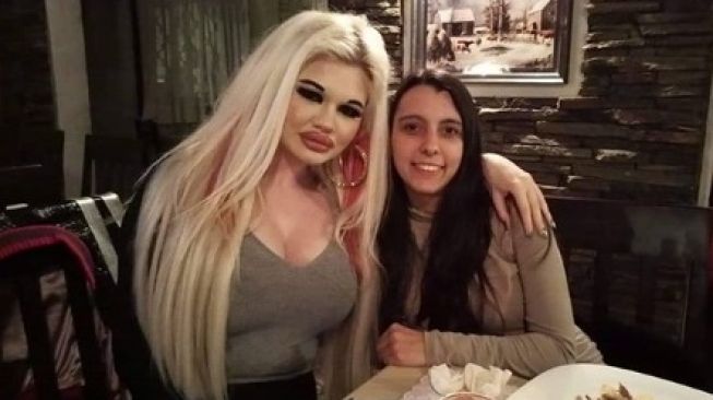 Andrea Ivanova, pemilik bibir terbesar di dunia. [Instagram]