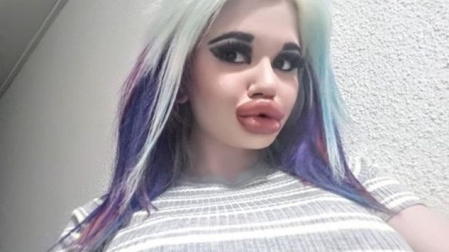 Andrea Ivanova, pemilik bibir terbesar di dunia. [Instagram]