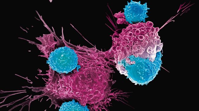 Sel T menghancurkan sel kanker (Adusumilli)