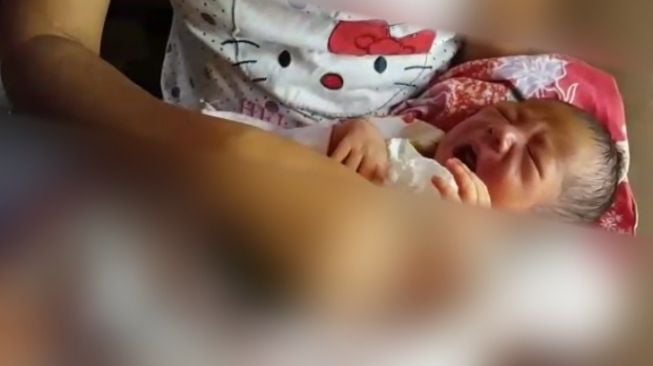 Bayi Lahir Tanpa Dinding Perut, Orang Tua Takut ke RS karena Tak Ada Biaya