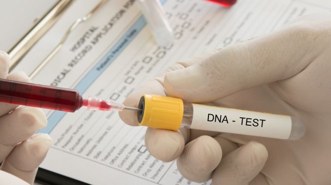 Ilustrasi tes DNA. (Shutterstock)