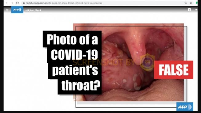 Penjelasan CEK FAKTA, penelusuran dari Fact Check AFP terkait foto yang diklaim tenggorokan pasien COVID-19 (turnbackhoax.id)