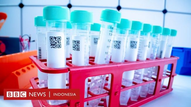 Inggris Uji Coba Tes Covid-19 No Swab, Potensi Temukan Pasien Tanpa Gejala