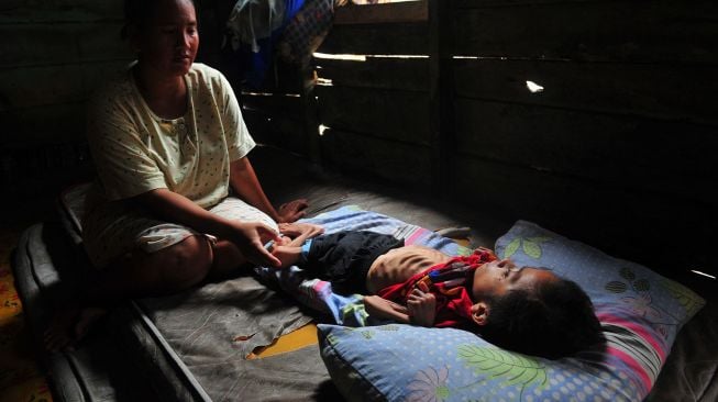 Muhammad Jumadil Ardiansyah (9) yang didiagnosa menderita gizi buruk terbaring  di rumahnya di Tungkal Ilir, Tanjungjabung Barat, Jambi, Sabtu (27/6/2020). [ANTARA FOTO/Wahdi Septiawan]