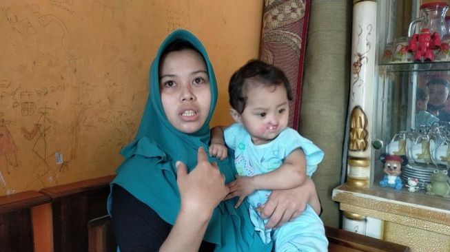  Rumaisa Salsabila Yanuar menderita penyakit langka. (Suara.com/Zian)