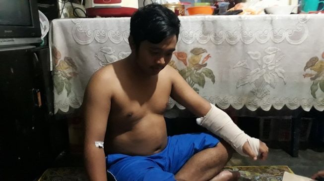 MR, korban pembacokan saat terjadi keributan warga di kawasan Kampung Melayu Besar, Kebun Baru. (Suara.com/Bagaskara).