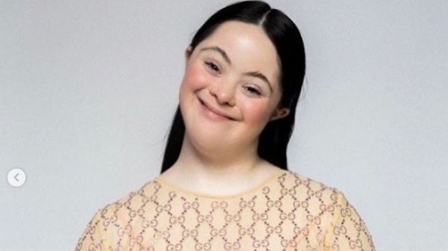 Salut! Potret Ellie Goldstein, Model Gucci dengan Kondisi Down Syndrome