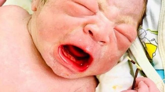 Bayi lahir sambil pegang alat kontrasepsi ibunya. (Twitter)