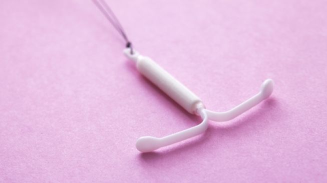 Ilustrasi kontrasepsi IUD. (Shutterstock)