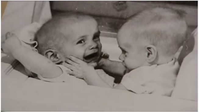Kembar siam tertua, Ronnie dan Donnie. (Youtube/NineLivesMedia)
