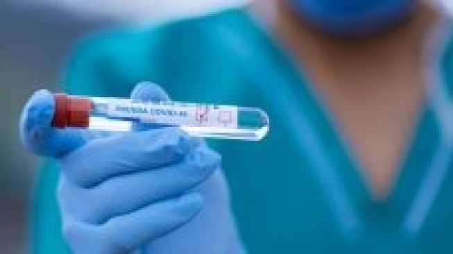 Ajudan Wagub Sumbar Positif Terjangkit Covid-19