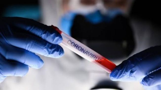 Hari ini Dua Warga Pessel Terkonfirmasi Positif Covid-19
