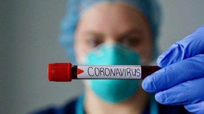 Seorang Kepala Desa di Karimun Positif Covid-19
