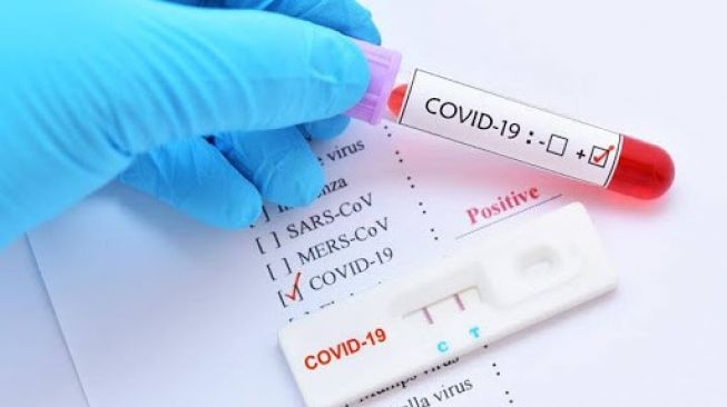 Kasus Covid 19 Sumbar: Positif 1.176, Sembuh 814, Meninggal 34
