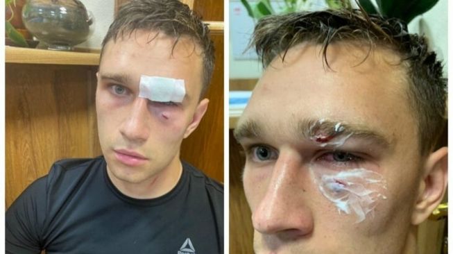 Nikita Danchenko jadi korban pemukulan Roman Shirokov. (Instagram)