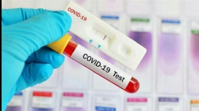 Empat Warga Tanah Datar Terkonfirmasi Positif COVID-19, Total Jadi 42
