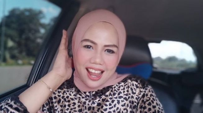 5 Potret Terkini Elly Sugigi Usai Potong Gigi hingga Kencangkan Kulit Wajah