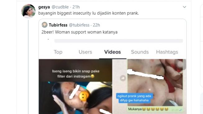 Heboh! Konten Prank Jerawat ini Tuai Komentar Pedas Warganet