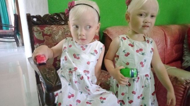 Anak Kembar Albino di Wonogiri Viral, Warga Berdatangan Untuk Foto