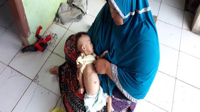 Miris, Anak Guru Ngaji di Bogor Badannya Tinggal Tulang, Habis Menyusut