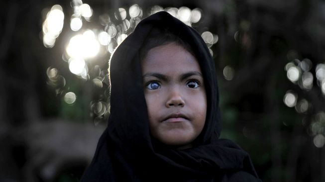 Seorang anak dari Suku Buton, Eni Wahyuni menunjukan bola mata berwarna biru dan kemerahan di Kendari, Sulawesi Tenggara, Rabu (16/9/2020). [ANTARA FOTO/Jojon]