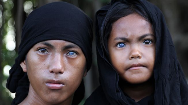 Syawal (kiri) dan Eni Wahyuni (kanan) menunjukan bola mata berwarna biru dan kemerahan di Kendari, Sulawesi Tenggara, Rabu (16/9/2020). [ANTARA FOTO/Jojon]