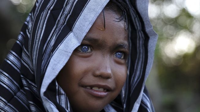 Seorang anak dari Suku Buton, Fardan memiliki mata berwarna biru di Kendari, Sulawesi Tenggara, Selasa (15/9/2020). Fardan merupakan salah satu dari belasan orang Suku Buton di Sulawesi Tenggara yang memiliki Sindrom Waardenburg yaitu kelainan genetik langka yang menyebabkan mata berwarna biru. [ANTARA FOTO/Jojon]