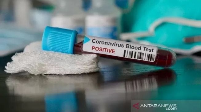 Daftar Laboratorium Tes PCR di Malang Raya yang Diakui Satgas Covid-19