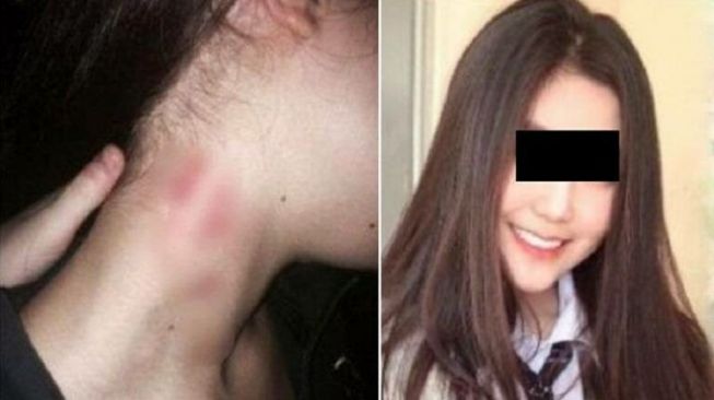 Curiga Ada Bekas Cupang, Orang Tua Gadis Kaget Anaknya Indehoi Sama 5 Pria