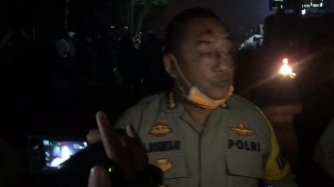 Karo Ops Polda Banten Kombes Amiludin Roemtaat mengalami luka di kepala diduga akibat lemparan batu saat pengamanan aksi demo mahasiswa di depan Kampus UIN Sultan Maulana Hasanuddin Banten, di Serang, Selasa. [Antara/Mulyana]