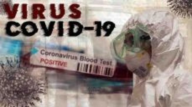 Puluhan Tenaga Kesehatan di Bandung Terpapar Covid-19