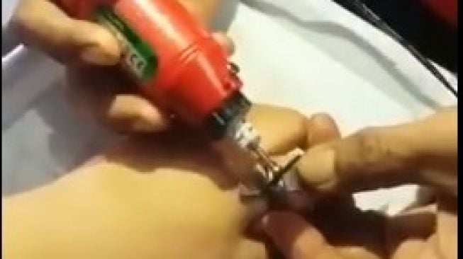 Evakuasi Cincin Nyangkut, Damkar Jogja: Terima Pemotongan Cincin Mantan