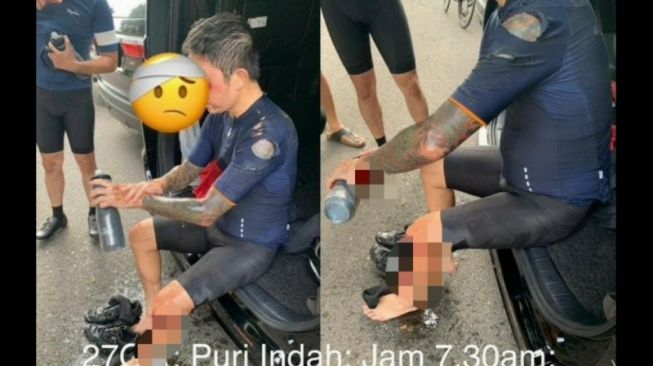 Pesepeda Hendra Gunawan (41) mengalami luka akibat saling tarik dengan begal yang akan menjambret ponselnya di Jalan Puri Indah Raya, Kembangan, Jakarta Barat, Selasa (27/10/2020). (ANTARA News/HO-Polres Metro Jakarta Barat)