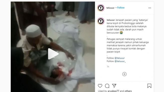 Geger Video Mayat Covid-19 yang Bola Matanya Hilang Diduga di Probolinggo