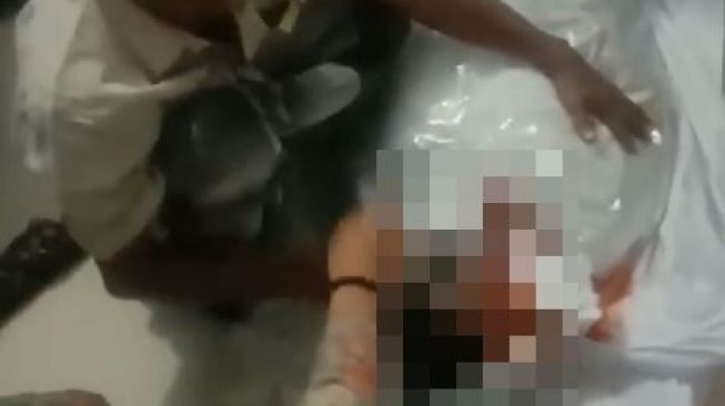 Viral Keluarga Sobek Kafan Jenazah Diduga Covid-19, Mata Berlumur Darah